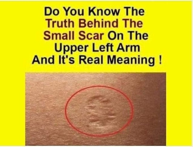 Do you know the true meaning of the little scar?