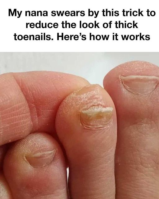 trick to reduce the look of thick toenails